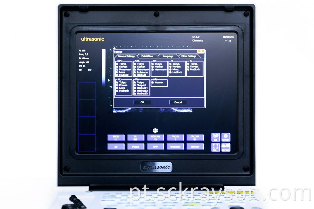 Laptop Ultrasound Screen 5